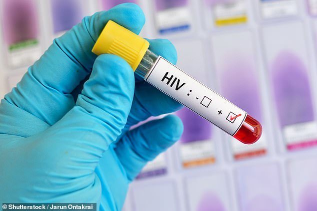 shutterstock image Hiv Viruse