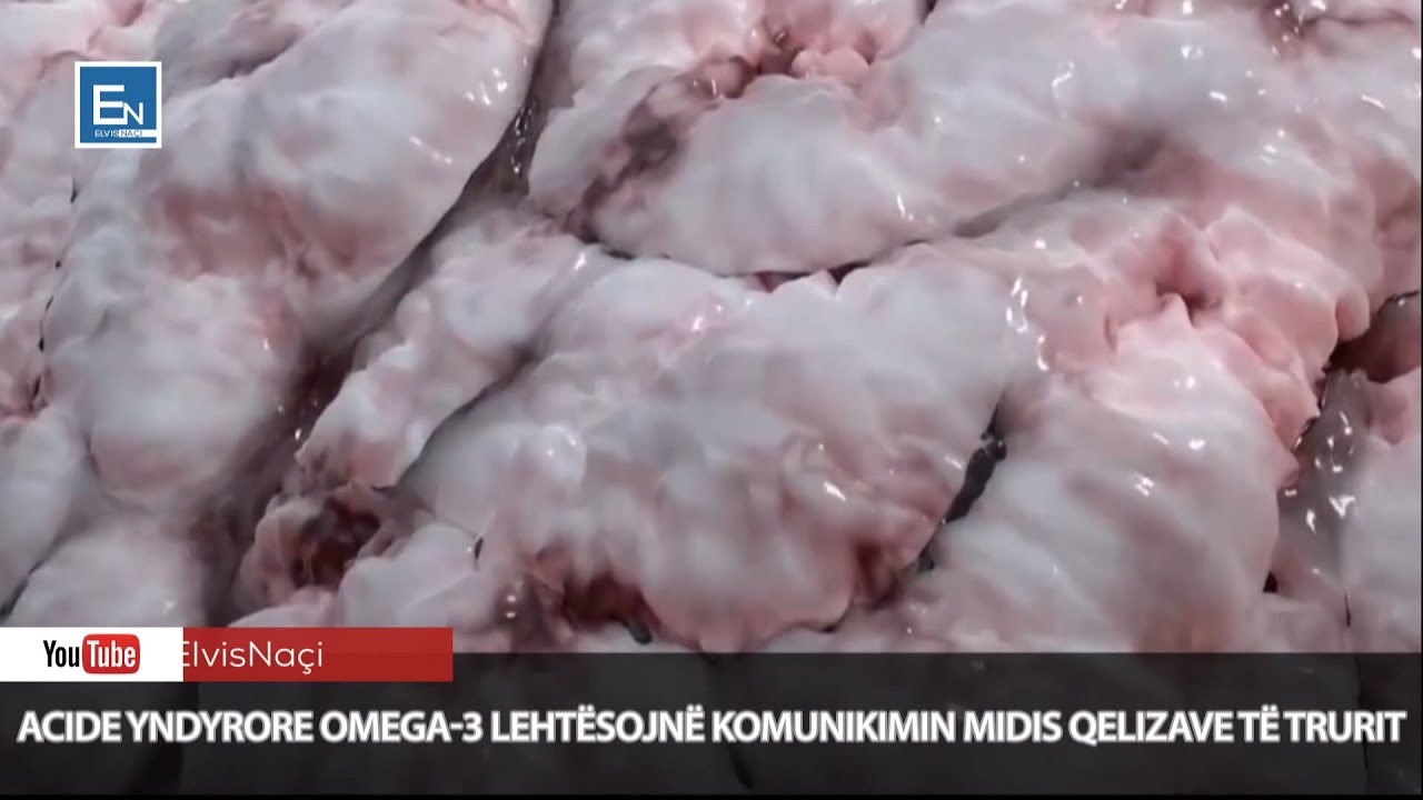 Roli i rëndësishëm i acideve yndyrore omega 3 në trurin e njeriut! Informacione mahnitëse!