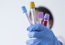 19 të infektuar me koronavirus, ku janë rastet e reja në Vlorë
