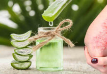 Përdorimi i aloe verës për psoriazën dhe probleme të tjera me lëkurën