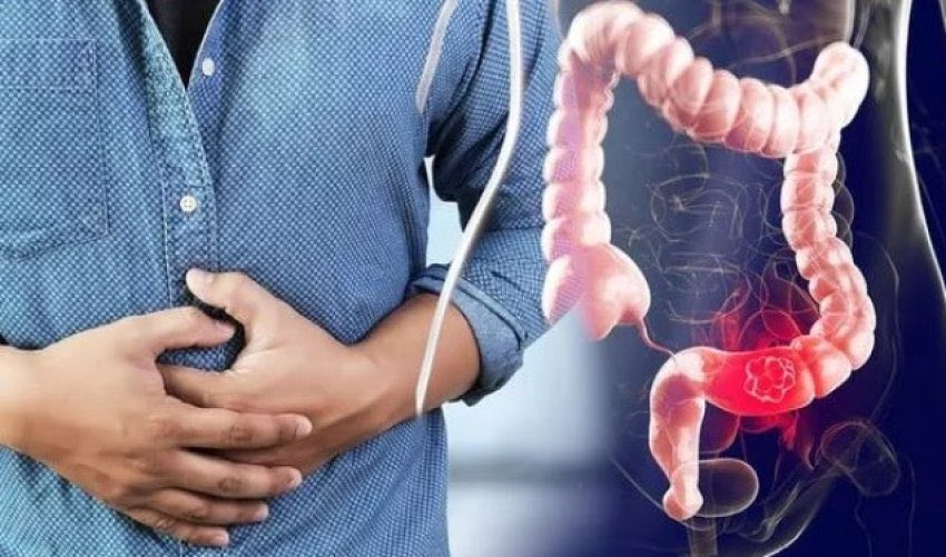 Ushqimet që ndikojnë në infeksionin e zorrës së trashe