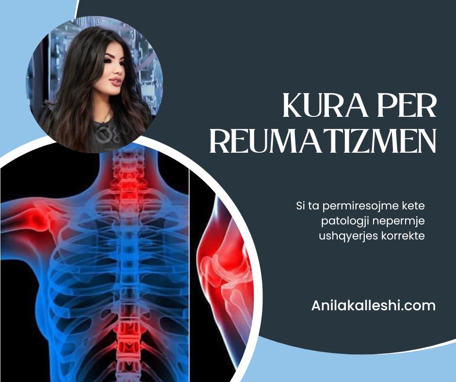 Ushqimet qe ndihmojne ne luften kunder reumatizmes