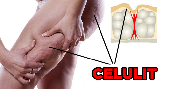 Dieta kundër celulitit
