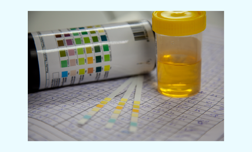protein-in-urine1.png