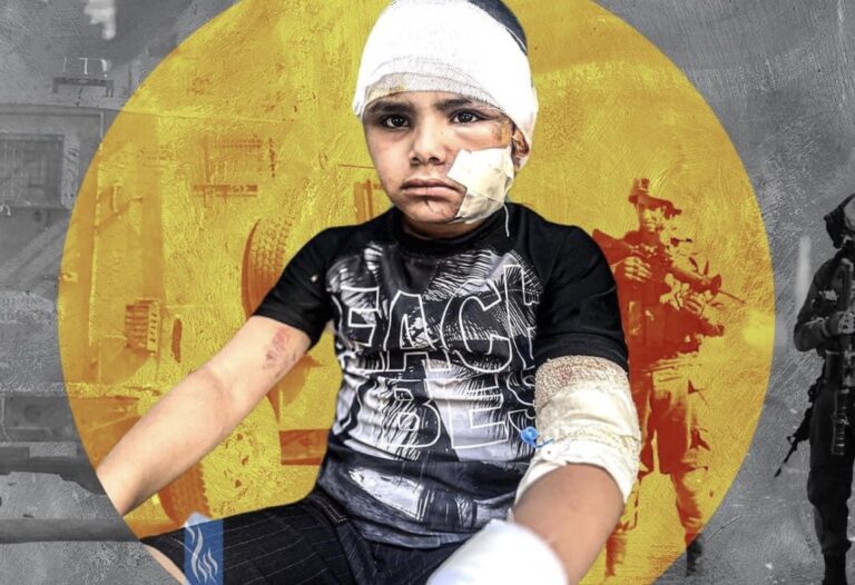 Mjekë dhe infermierë amerikanë: Fëmijët në Gaza, të “shënjestruar qëllimisht”
