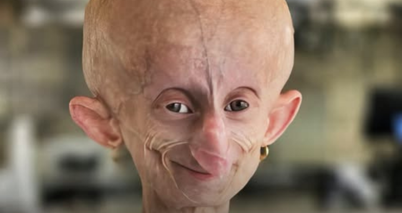 Sfidoi sëmundjen e plakjes së shpejtë, humb jetën influencerja 19-vjeçare