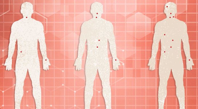 Rritet numri i personave të infektuar me HIV/AIDS në Shqipëri, mes tyre 4 fëmijë të vegjël