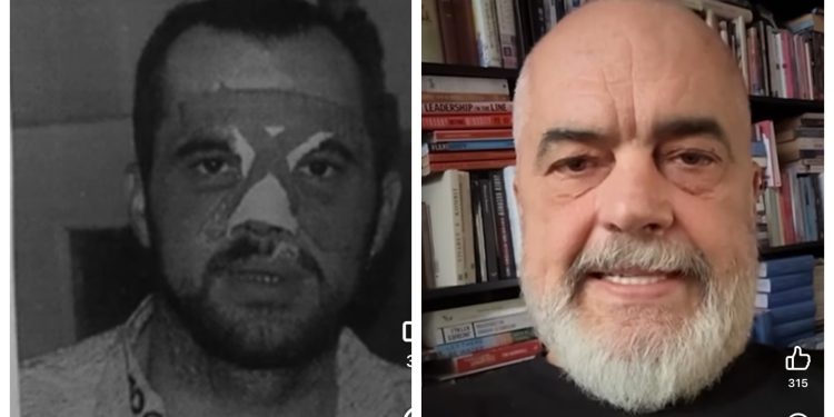 “Hundën ma ka thyer katranpartia që ta ka mbushur mendjen se jam drogaxhi ” Rama i përgjigjet komentuesit dhe kujton vitin ’97: Më lanë në rrugë mbuluar me gjak dhe… 11 IMG 3130 750x375 1