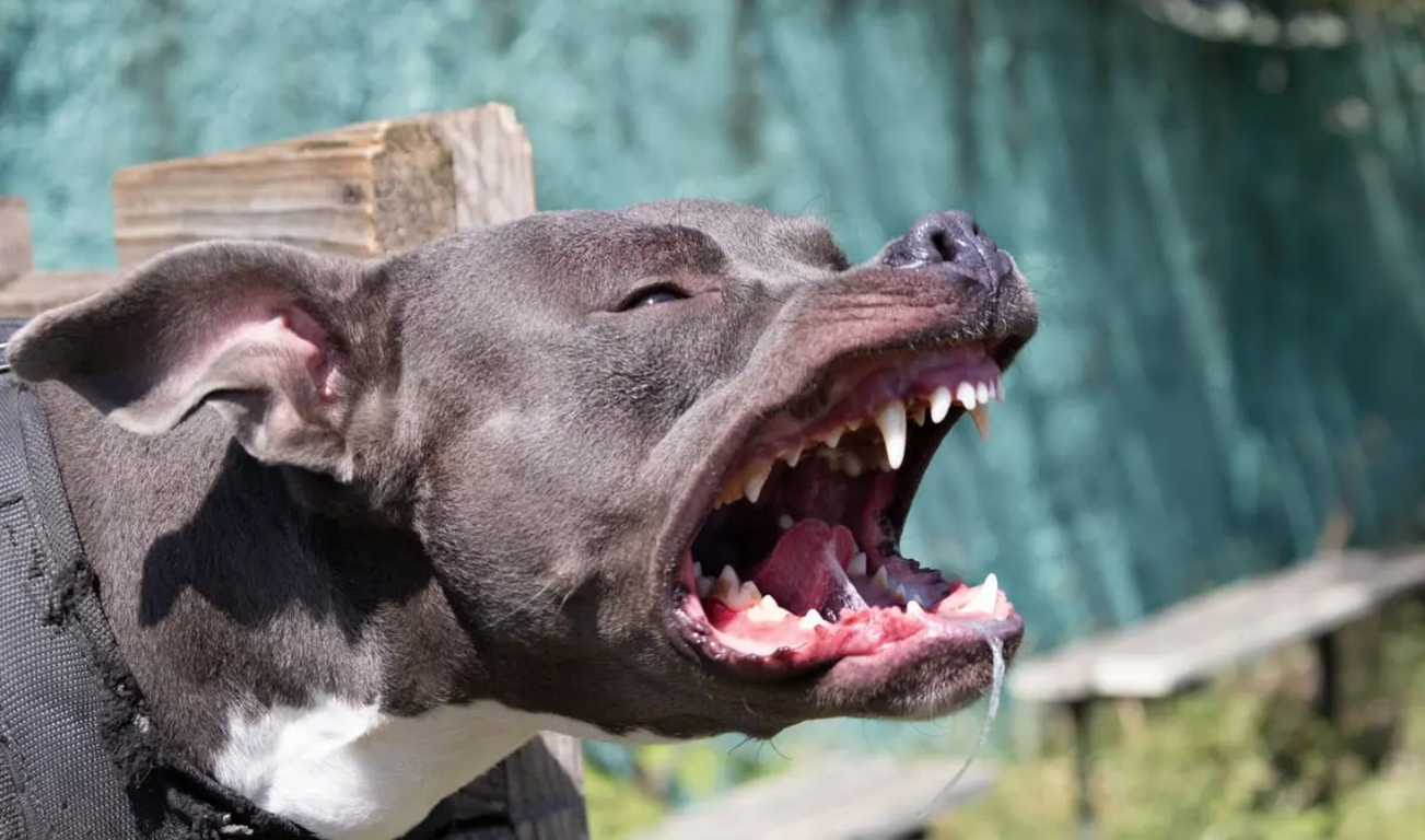 Gruaja sulmohet dhe e plagoset në kokë nga tre pitbull: fotot të tmerrshme 19 Progetto senza titolo 1 9