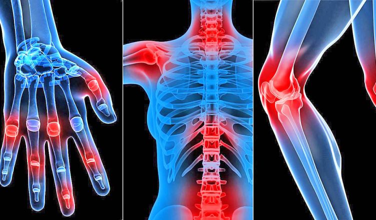 Shtojnë rrezikun e shfaqjes së osteoporozës, si ndikojnë duhani dhe alkooli tek shëndeti i kockave!