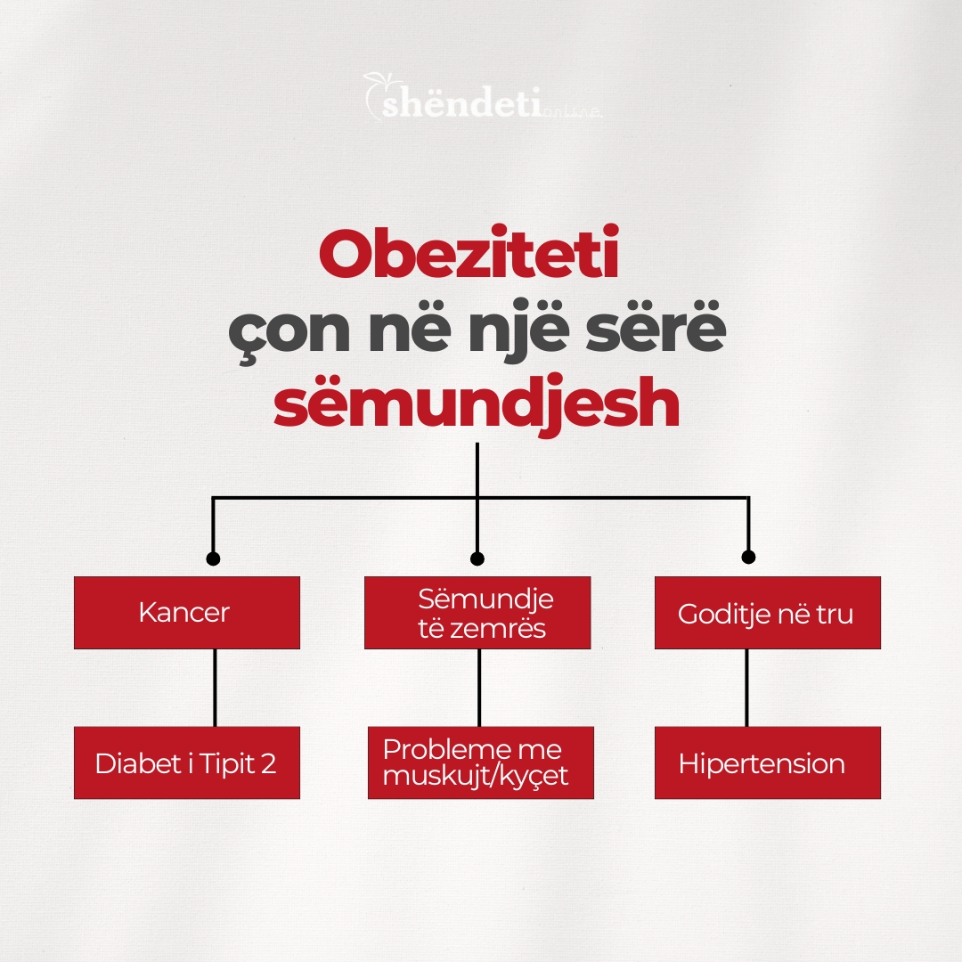 1 në 8 njerëz në botë vuan nga obeziteti