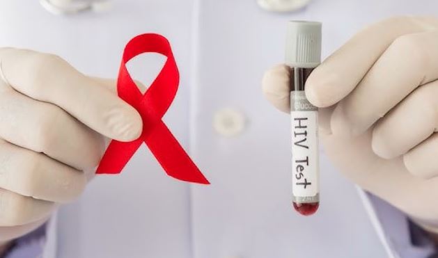 HIV zbulohet vonë, 50% e rasteve të reja në 2024 ndërruan jetë