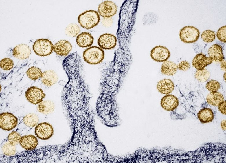 Çfarë duhet të dini për sindromën pulmonare hantavirus