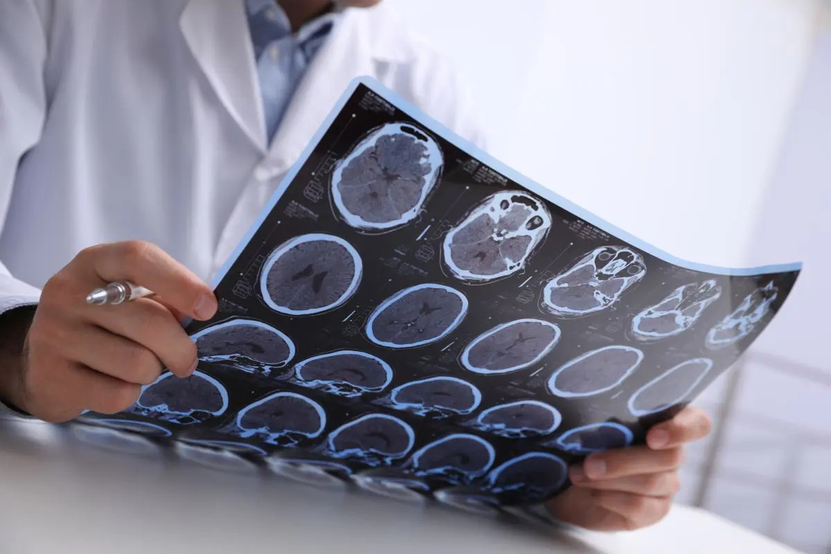 Parkinson, alarmi bie mes të rinjve në Europë : të dhënat më të fundit