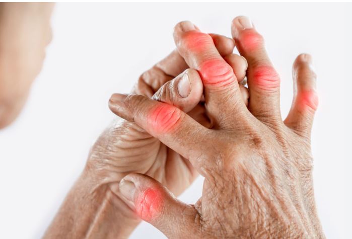 Si mund të dalloni nëse keni artrit reumatoid ose osteoartrit?