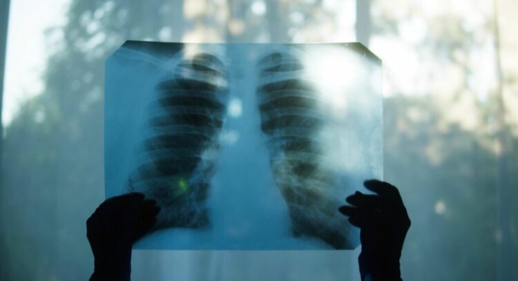 Shtohen rastet me sëmundje kronike pulmonare, mjekja tregon si duhen trajtuar