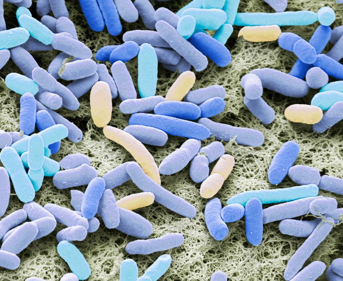 OBSH paralajmëron për rezistencë të infeksioneve ndaj antibiotikëve në të gjithë botën
