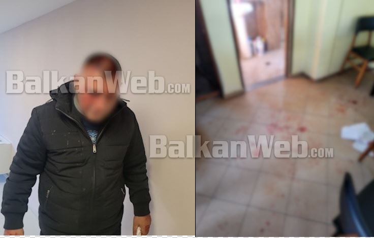 “Urdhri u dha nga Gëzimi”/ U dhunua nga maskat në mes të lokalit, Nikolin Marku: Si më kërcënoi vëllai i ish-deputetit të PS në spital 12 nikolin marku rrahja ne lezhe