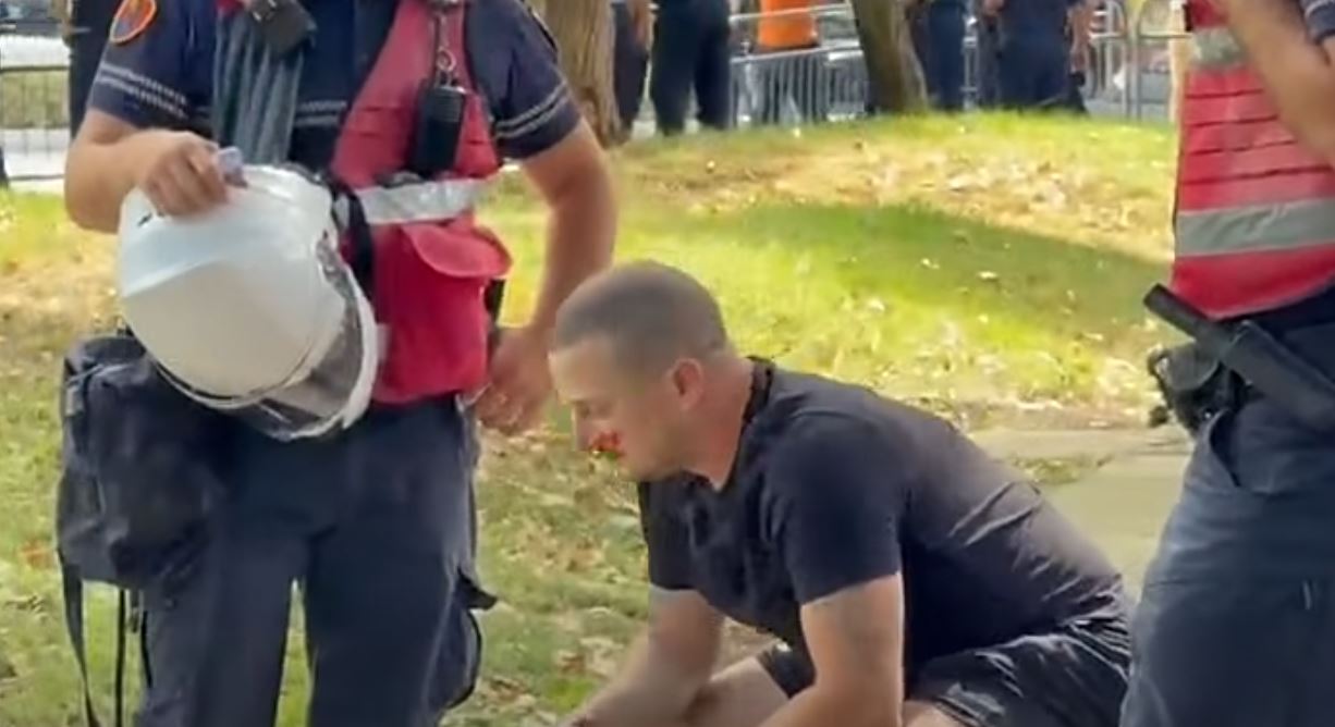 Berisha: Përgjaket protesta. Pasi e përgjakin narkopolicët lajnë duart si Pilati! 15 8888888888
