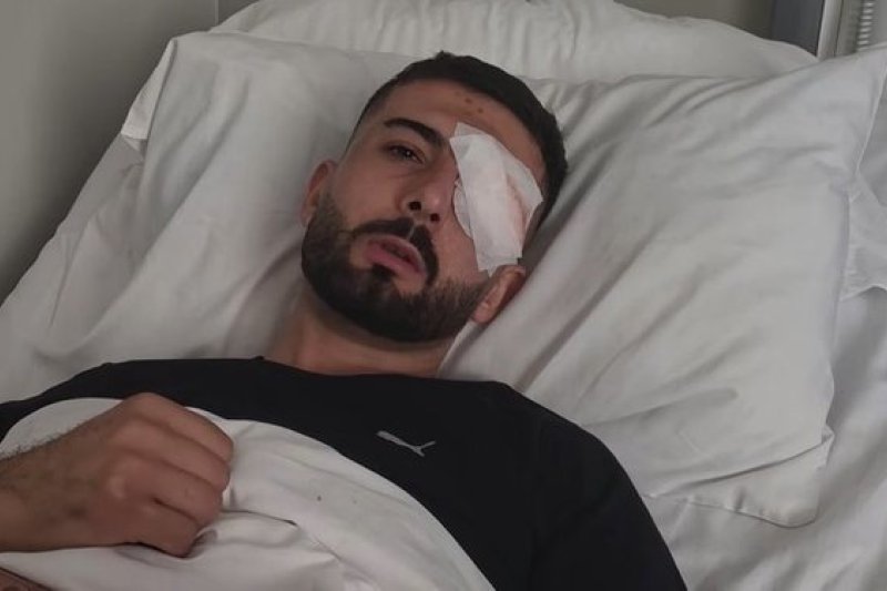 U plagos me plumb gome në sy gjatë protestës, MSHMS: Erjon Vishkulli kalon me sukses operacionin në Romë 8 IMG 2015