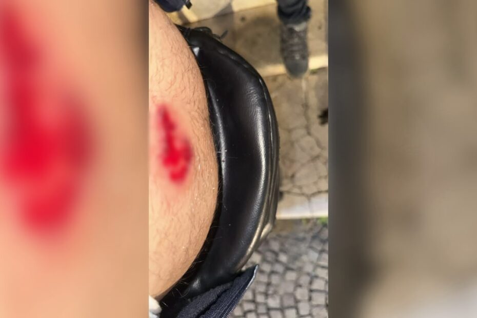 Lëndohet operatori i News24/ Elvin Kamberi mbetet i dëmtuar gjatë përplasjes me policinë ndërsa xhironte në terren 13 WhatsApp Image 2026 10 14 at 21.29.20